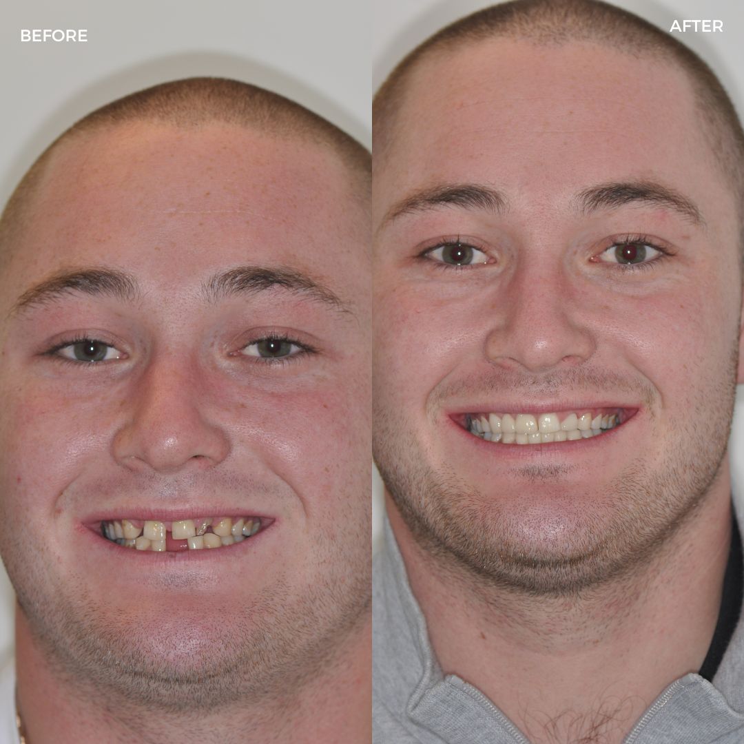 Village Dental - Helping Our Patients Smile Again