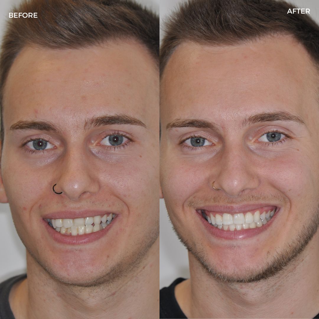 Village Dental - Helping Our Patients Smile Again