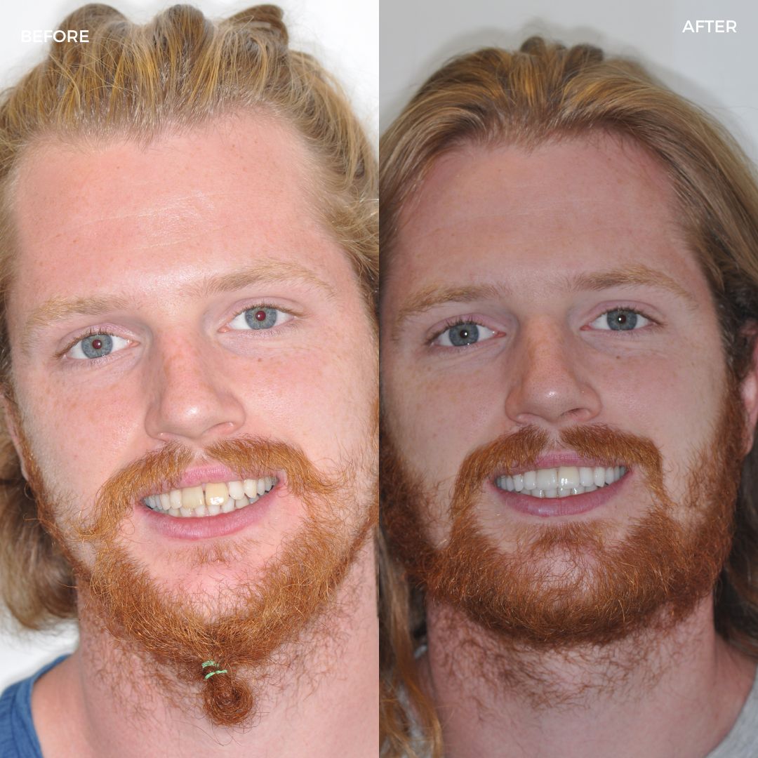 Village Dental - Helping Our Patients Smile Again