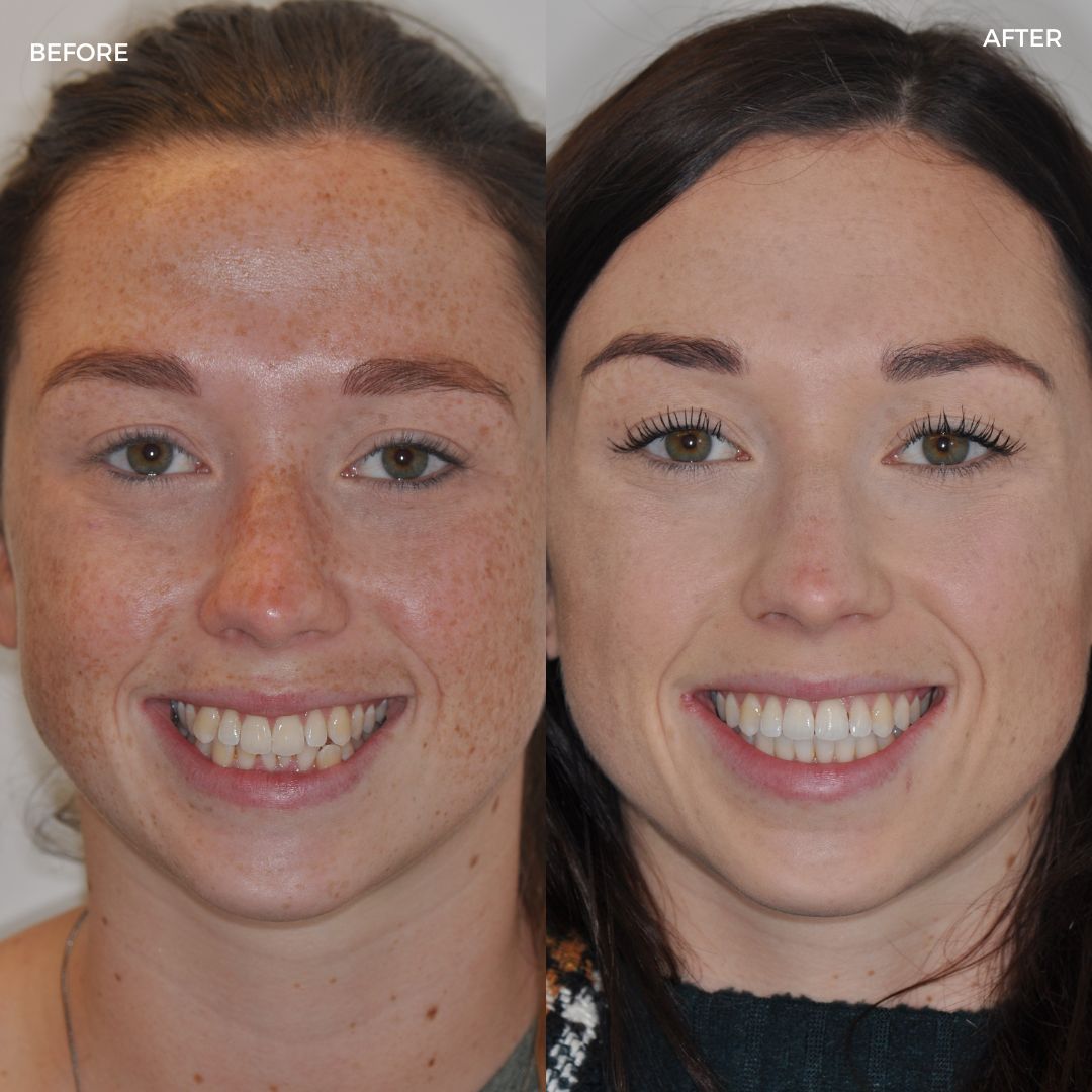 Village Dental - Helping Our Patients Smile Again