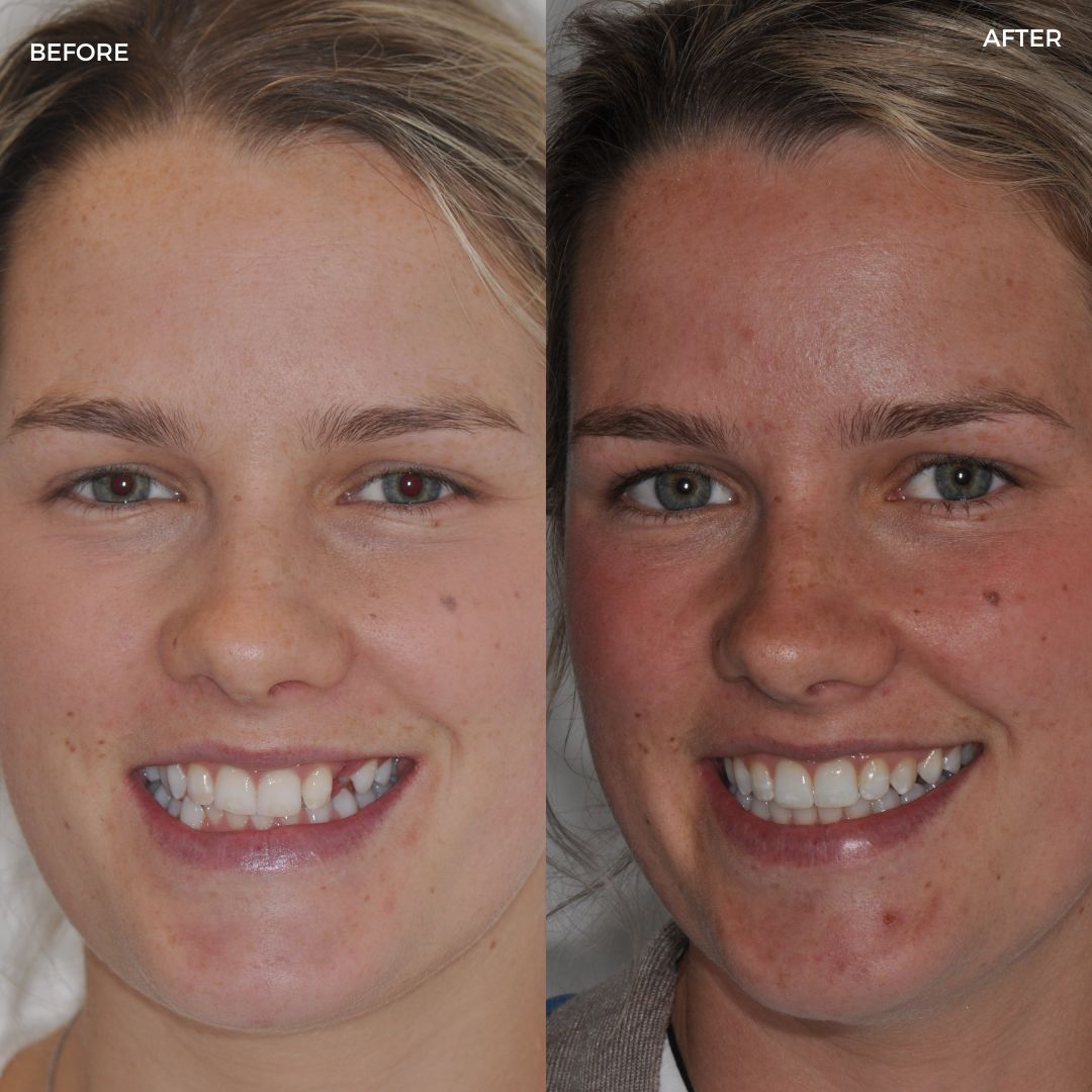 Village Dental - Helping Our Patients Smile Again