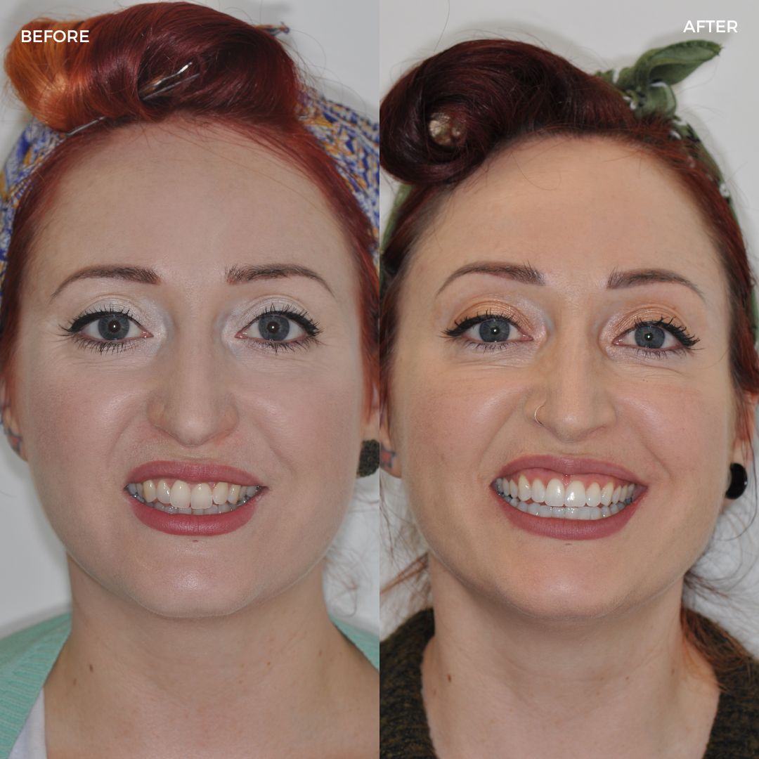 Village Dental - Helping Our Patients Smile Again