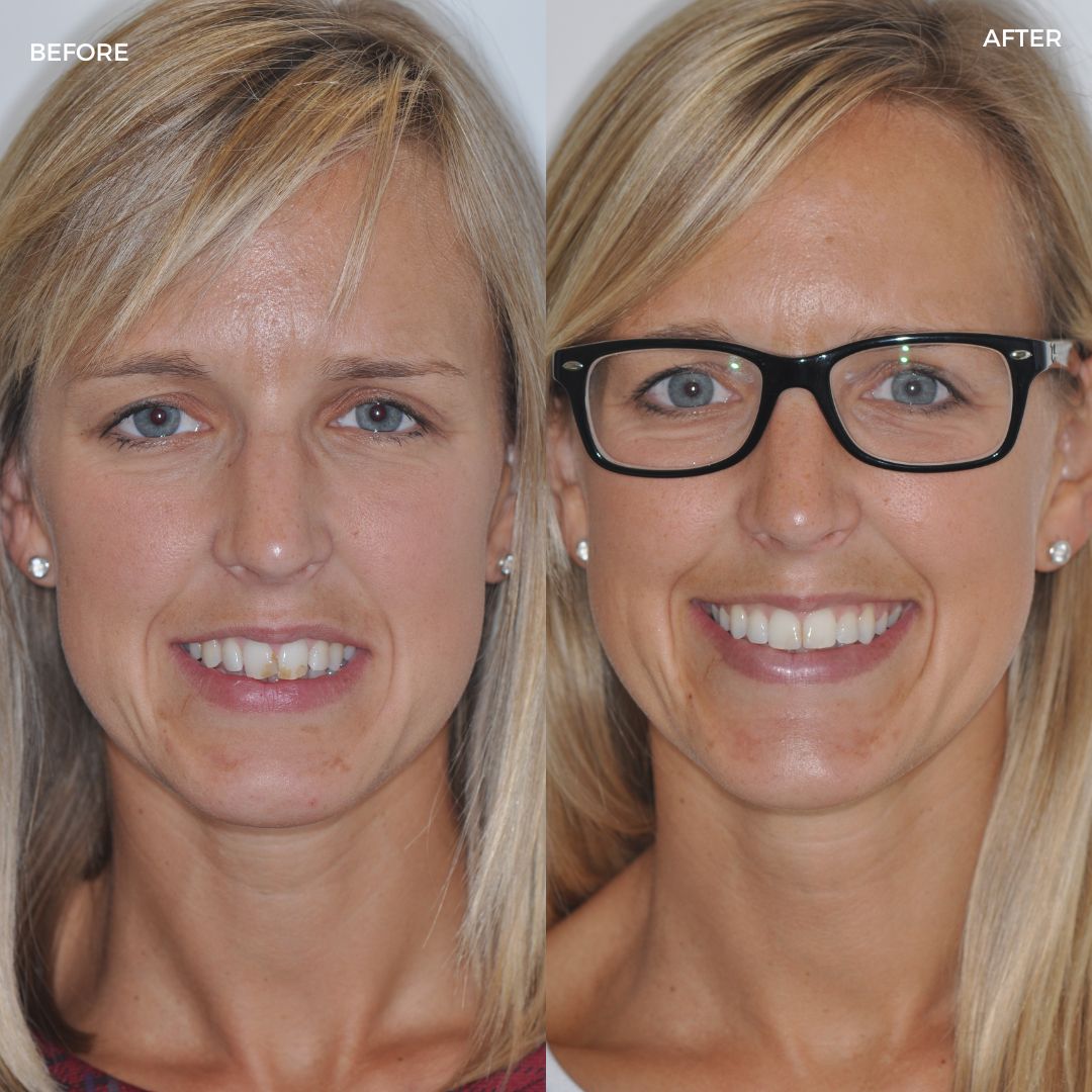 Village Dental - Helping Our Patients Smile Again